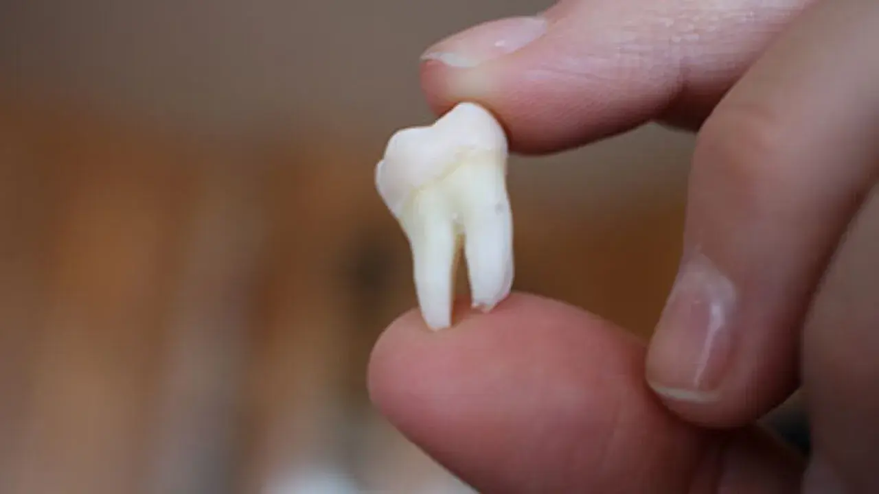 Cirugía Oral